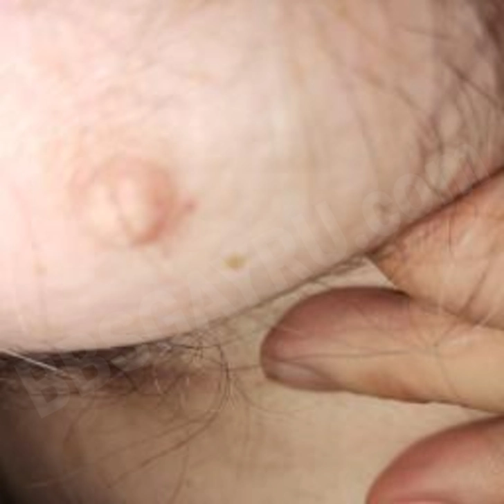 Медведи, чабы, волосатые Москва: Пончик 47 лет (пассив) 1