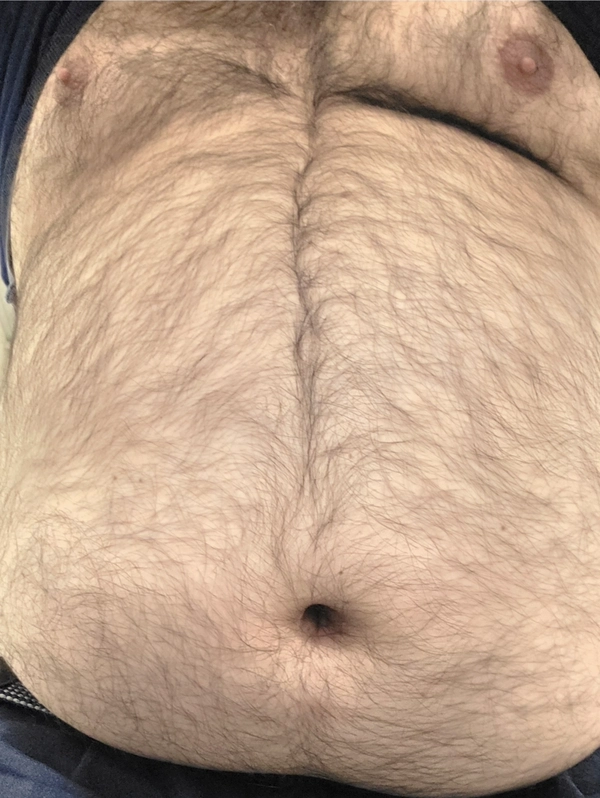 ProfitTro11115001012