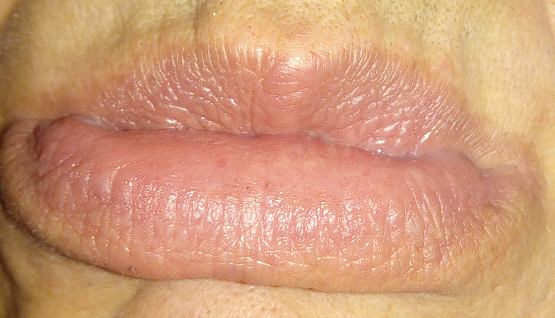 wafflelips4979686