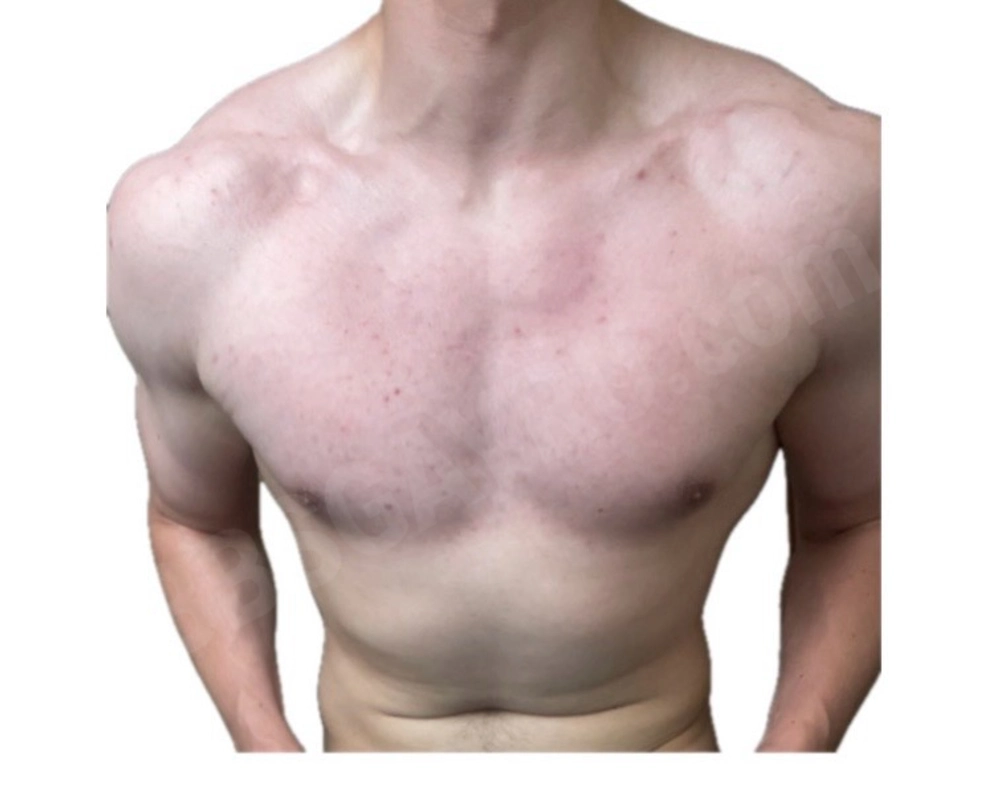 YoungSportMan4995281