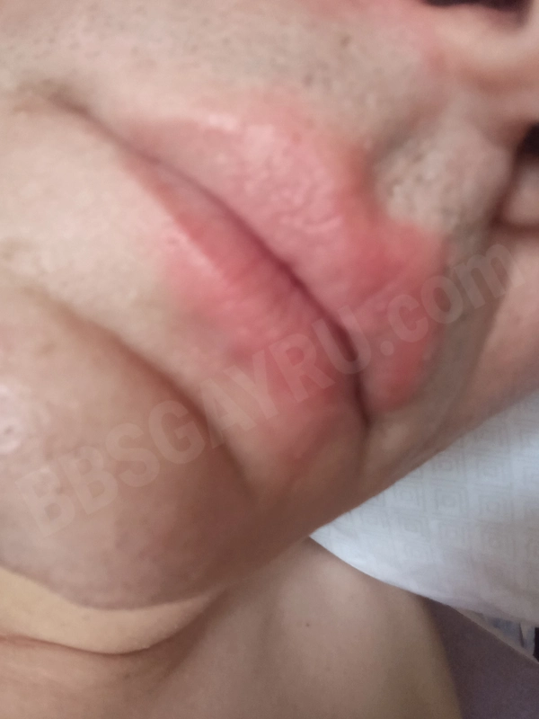 Raminasoska4470451