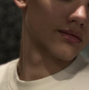 artem